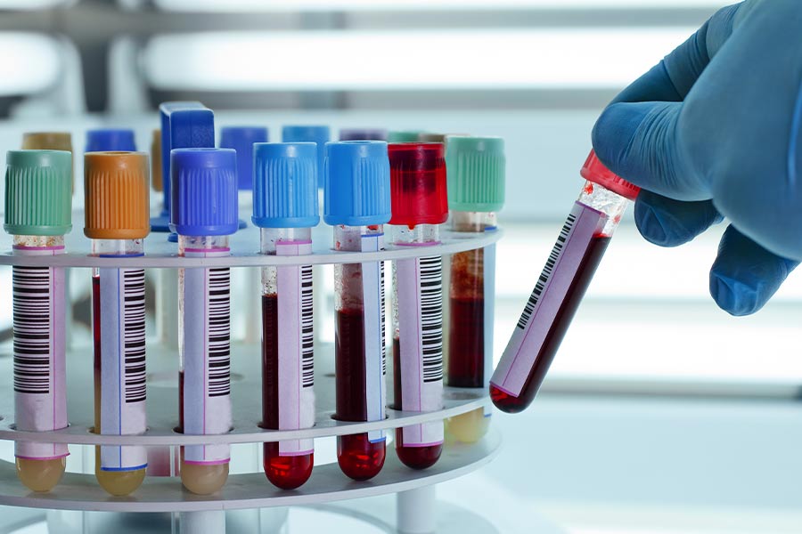 真空采血