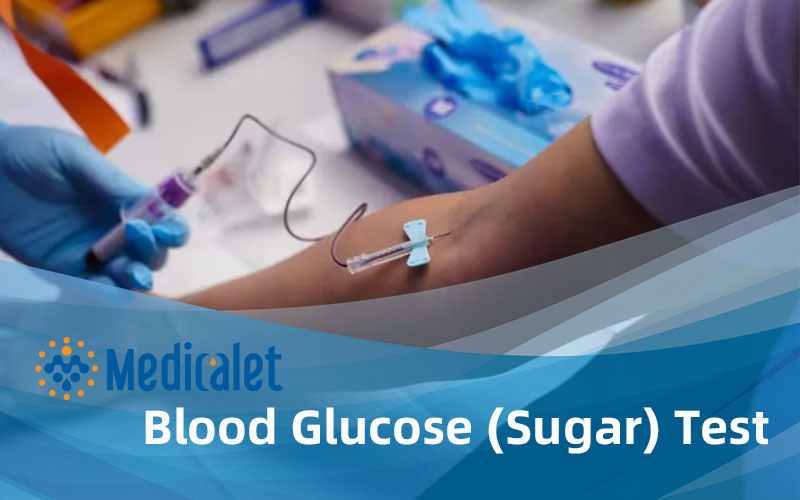 Blood Glucose (Sugar) Test